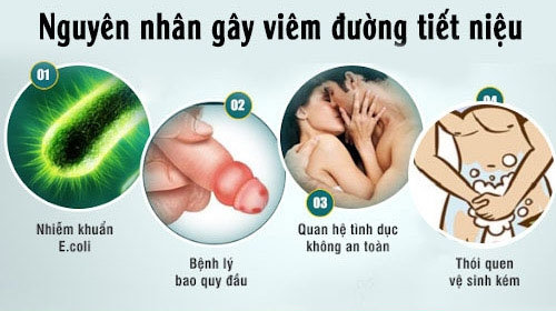Nguyên nhân và cách điều trị đau buốt khi xuất tinh là gì?