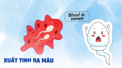 Cảnh Báo Xuất Tinh Ra Máu Tìm Hiểu Cách Điều Trị Hiệu Quả!