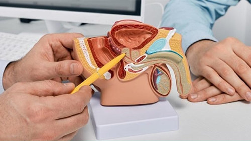 Bác sĩ nam khoa giải đáp: Tại sao đang quan hệ thì xìu, cách khắc phục