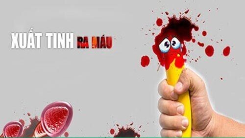 Xuất tinh ra màu đỏ là biểu hiện của nhiều bệnh lý nguy hiểm