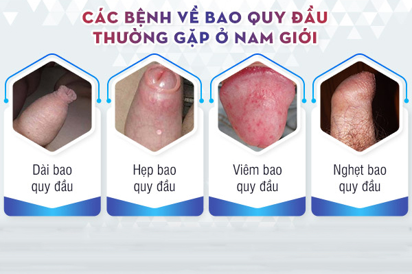 Phòng khám chuyên khám bao quy đầu tại Đắk Lắk