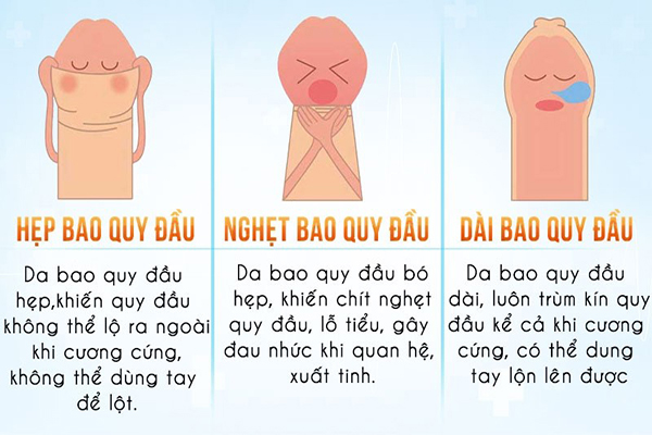 Phẫu thuật cắt bao quy đầu an toàn không?
