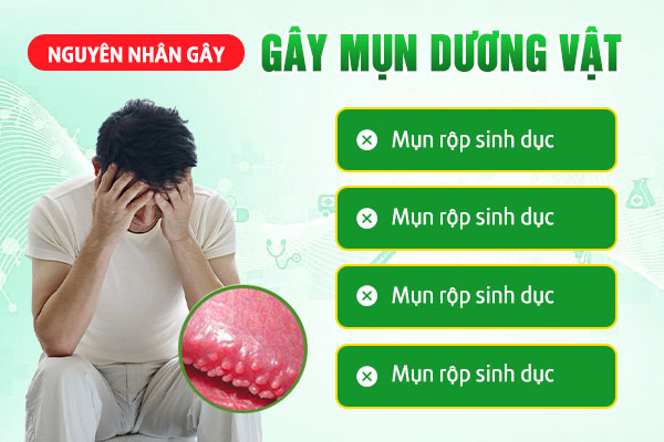 MỤN DƯƠNG VẬT LÀ DẤU HIỆU CỦA BỆNH GÌ? CHỮA NHƯ THẾ NÀO?