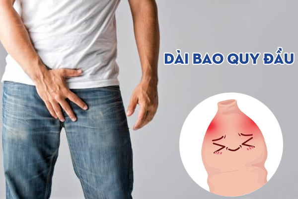 Dài bao quy đầu là như thế nào? Dấu hiệu nhận biết sớm