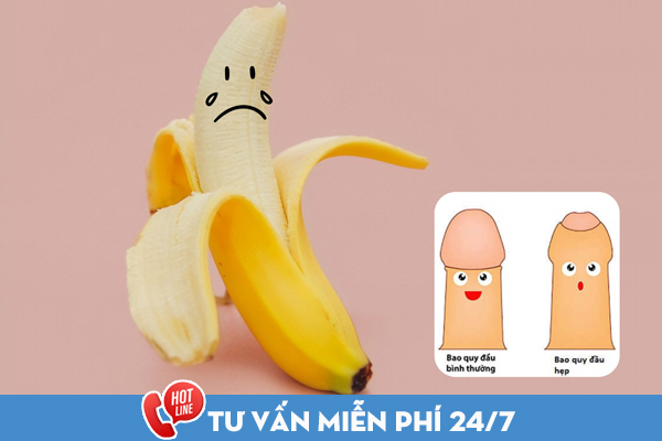 Hẹp bao quy đầu có sao không? Biện pháp điều trị hiệu quả