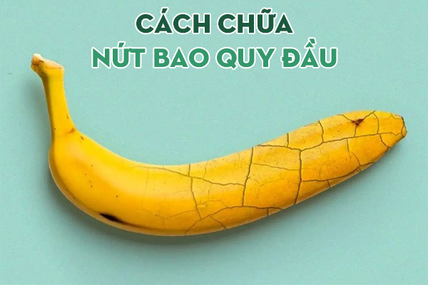 Nên làm gì khi bị nứt bao quy đầu? Biện pháp chữa trị hiệu quả nhanh