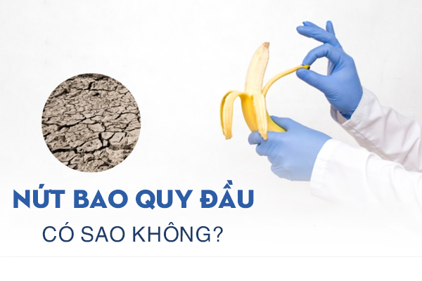 Nứt bao quy đầu có sao không? Triệu chứng chớ xem nhẹ