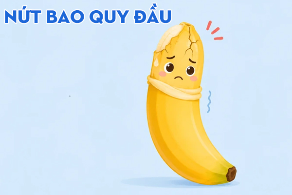 Chuyên gia khuyến cáo các nguyên nhân gây nứt bao quy đầu dễ gặp