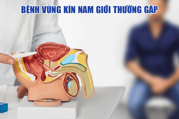 Cảnh báo 8 bệnh vùng kín nam giới thường gặp