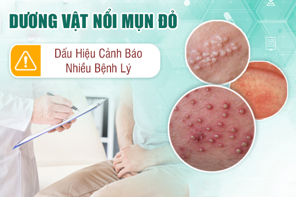 Nguyên nhân dương vật nổi mẩn đỏ, mụn đỏ – Khám điều trị ở đâu?