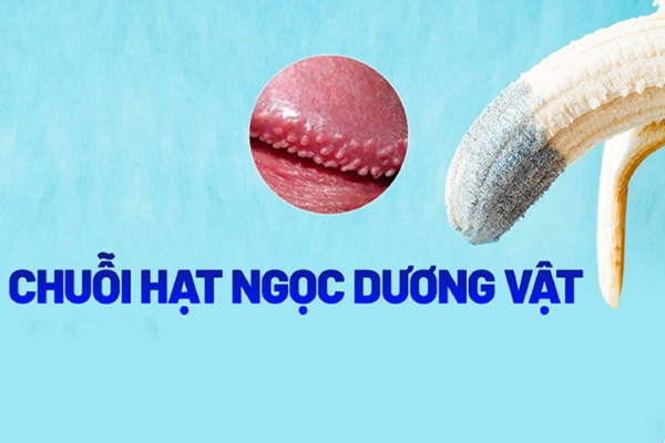 Hạt ngọc dương vật là bệnh gì? Các dấu hiệu nhận biết bệnh