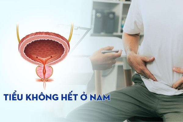 Tiểu không hết là bị gì? Điều trị như thế nào?