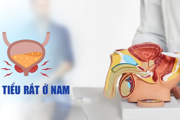 Tiểu rắt ở nam – Dấu hiệu không thể xem thường