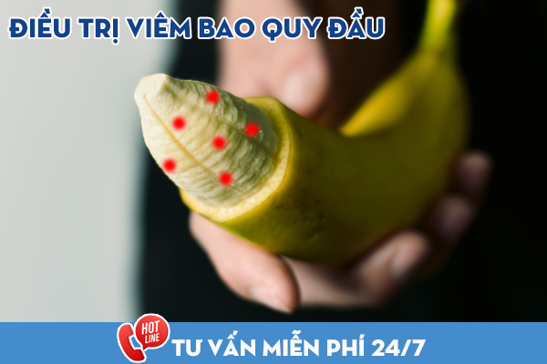 Điều trị viêm bao quy đầu bằng phương pháp nào? Địa chỉ khám chữa bệnh uy tín ở Đắk Lắk