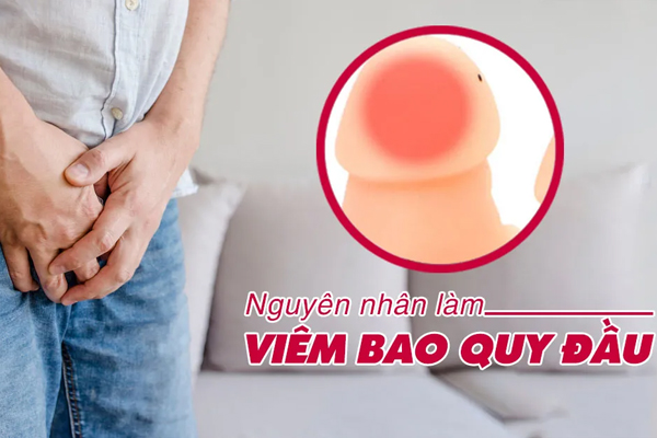 Nguyên nhân gây viêm bao quy đầu là do đâu?