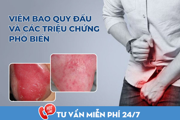 Dấu hiệu viêm bao quy đầu điển hình ở nam giới